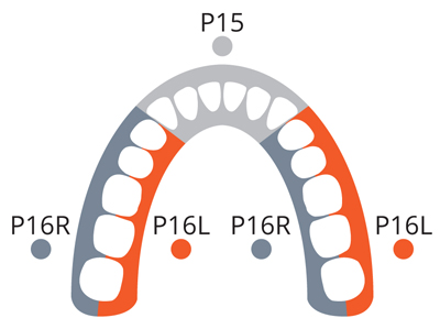 Насада для ультразвукового скалера P15 для фронтальной группы зубов